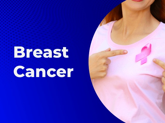 Breast Cancer