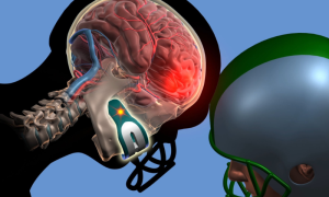 World Rugby Introduces Smart Technology to Control Head Injuries (1)