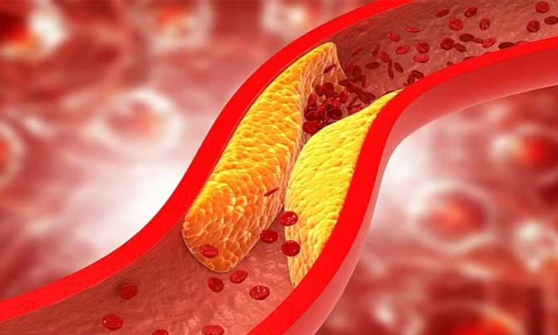 Scientists, Cholesterol, protein, heart, LDL, Molecular