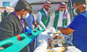 KSrelief, Eritrean, King Salman, conjoined, twins, surgical separation