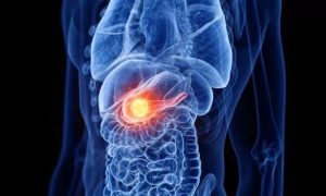 Scientists, cancer, Death Star, KRAS, Cancer Treatment