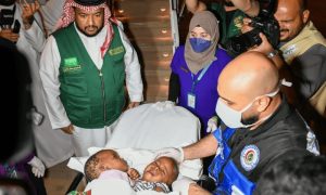 UN, Saudi Arabia, UNICEF, WHO, United Nations, World Conjoined Twins Day,