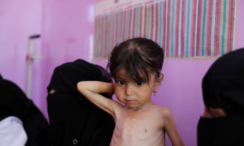 Yemen, Famine, United Nations, UN, European Union, UN Security Council, Houthi, UNICEF