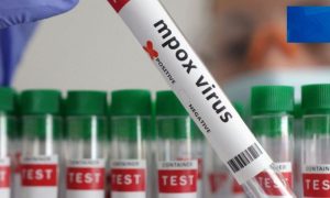 Germany, infection, mpox variant, clade 1b, Robert Koch Institute health authority, Germany,