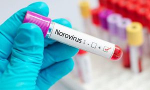 Norovirus, infection, contagious, vaccine, spike, United States
