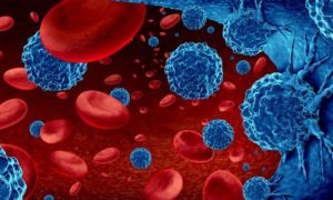 Pakistan, Punjab, Blood Cancer, WHO, Flow Cytometer Machine, Children’s Hospital Multan