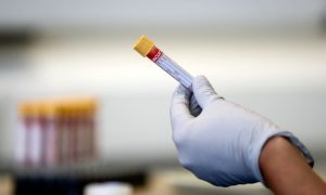 Blood Test