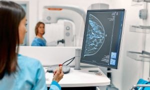 AI, Breast Cancer, Mammogram, Artificial Intelligence,