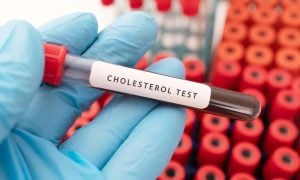 Cholesterol