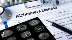 Alzheimer's Disease