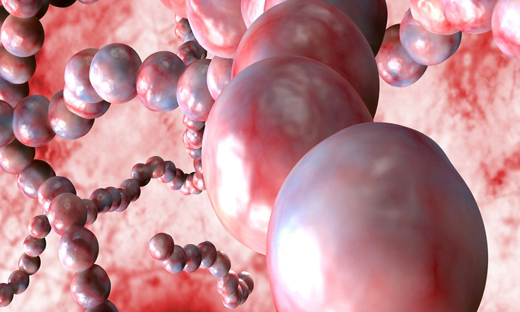 Bacterial infection