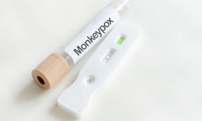 Health, expert, public, monkeypox