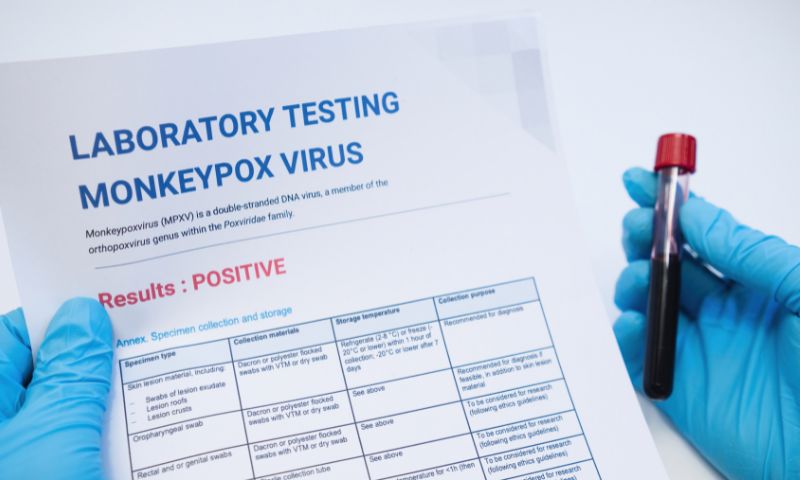 The Monkeypox and Health Security