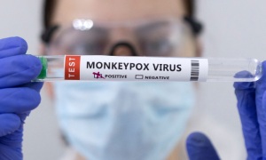 Monkeypox, Virus, Health, Experts, Officer, Hygiene