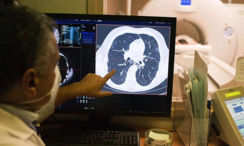 Cancer, Lung, Pill, Cuts, Risk, Death, Health, Study, Clinic, United States, AstraZeneca, Chicago,