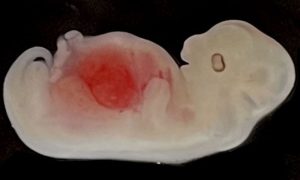 Kidneys
