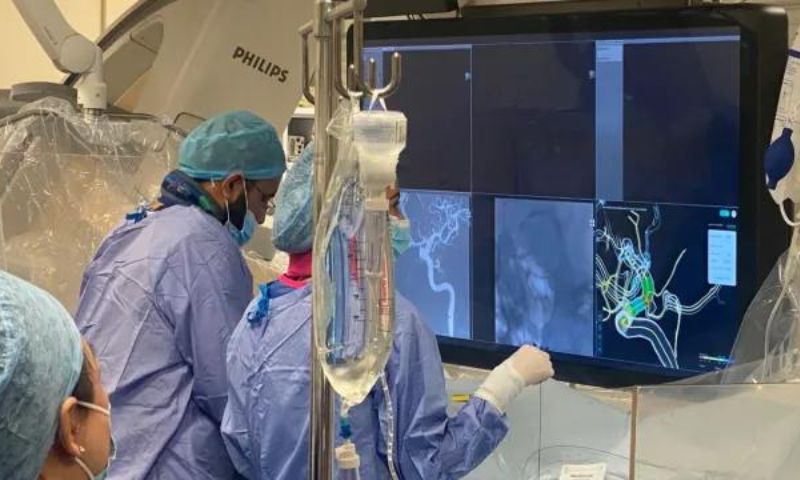 AI, Technology, Brain Aneurysm, Treatment, Software, PreSize, Neurosurgeons, Stents, Brain, Blood, Oxford, Heartbeat, Digital, Devices, England, Scotland, Germany, Finland, Ukraine, Health, Journal, Healthcare,