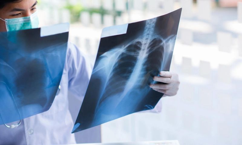 WHO, TB, Disease, World Health Organization, Tuberculosis, Covid-19, AIDs, Malaria, Global Fund, Pandemic,