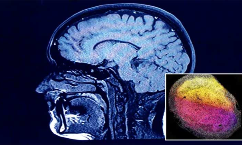 Breakthrough in Neurological Research as Scientists Grow Minibrains in Lab