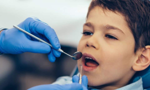 Ignoring Oral Health Can Lead to Facial Deformities: Experts