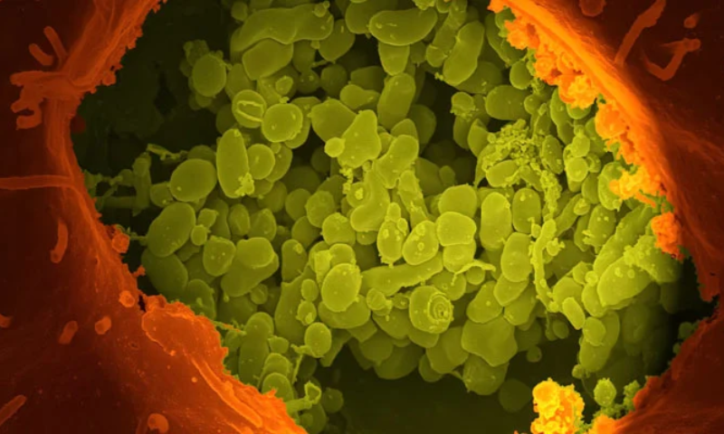 Gut, Bacteria, Viruses, Rise, Risk, Type 2, Diabetes