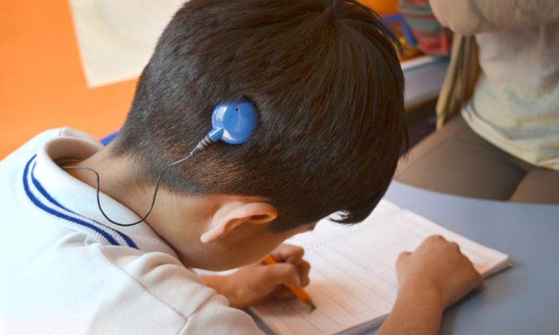 Saudi Arabia, Ministry of Health, Cochlear Implant