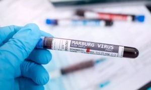 WHO, Rwanda, Marburg Virus, Ebola, UN,