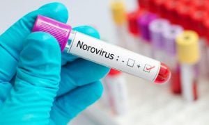 Norovirus, infection, contagious, vaccine, spike, United States