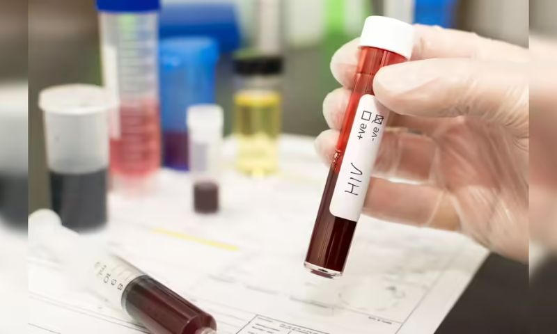 AIDS, UNAIDS, US, Funding, Aid, United Nations, United States, HIV, South Africa,