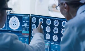 Neurological Disorders, Brain Health, WHO, Stroke, Migraine, Alzheimer's Disease, Meningitis, Idiopathic Epilepsy