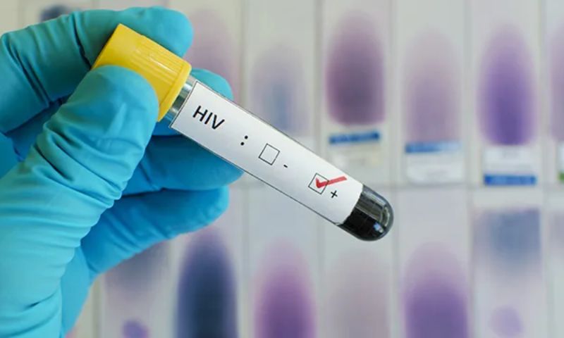 HIV