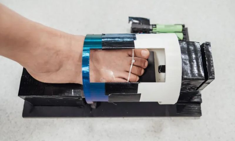 New Oxygen Gel Shows Promise in Healing Chronic Diabetic Wounds