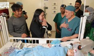 Saudi Medical Team Successfully Separates Filipino Conjoined Twins After Six-Hour Surgery
