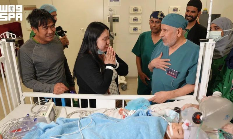 Saudi Medical Team Successfully Separates Filipino Conjoined Twins After Six-Hour Surgery