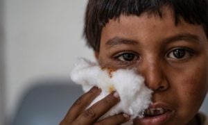 Leishmaniasis