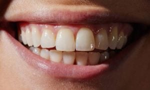 mouth