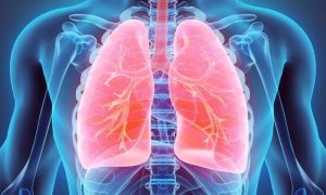 Saudi Arabia Approves Nerandomilast for Idiopathic Pulmonary Fibrosis